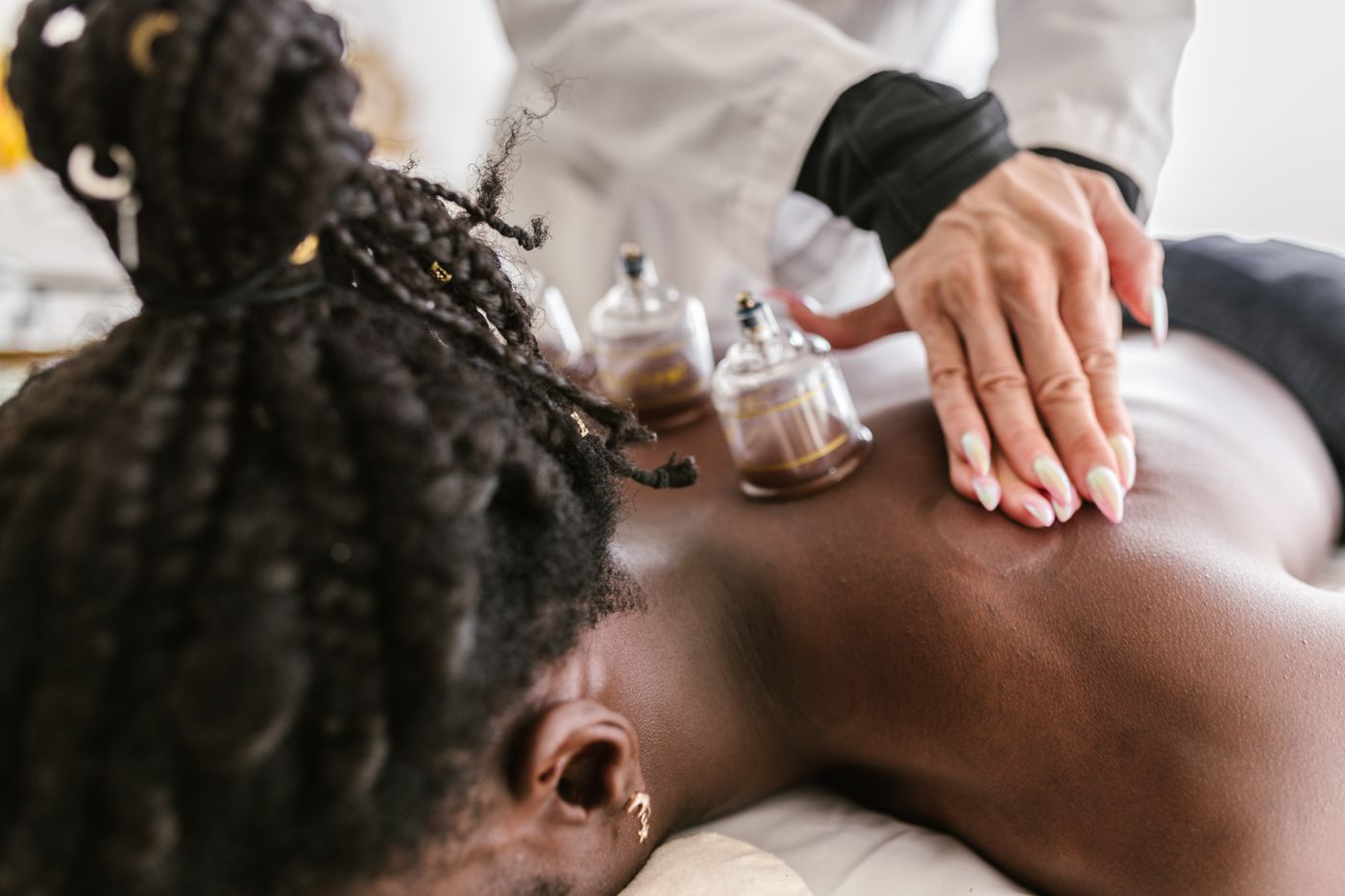 Therapist applying glass cups to the back in cupping therapy in Dubai